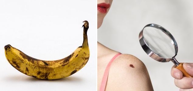 banana-cancer-getty.jpg