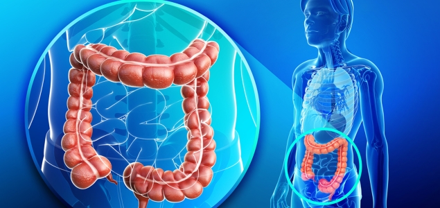 Colorrectal-colon-cancer-GETTY-635-300.jpg
