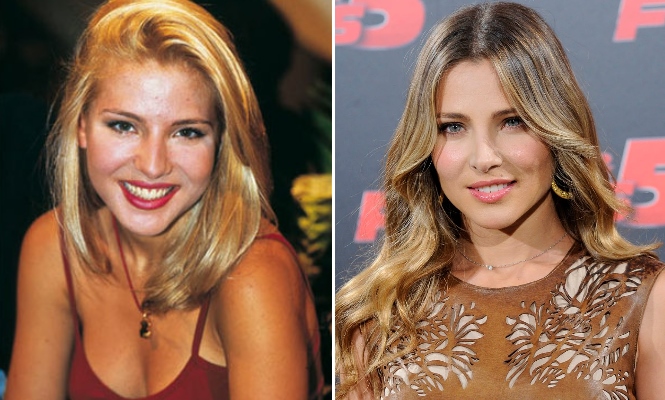 elsa pataky operaciones