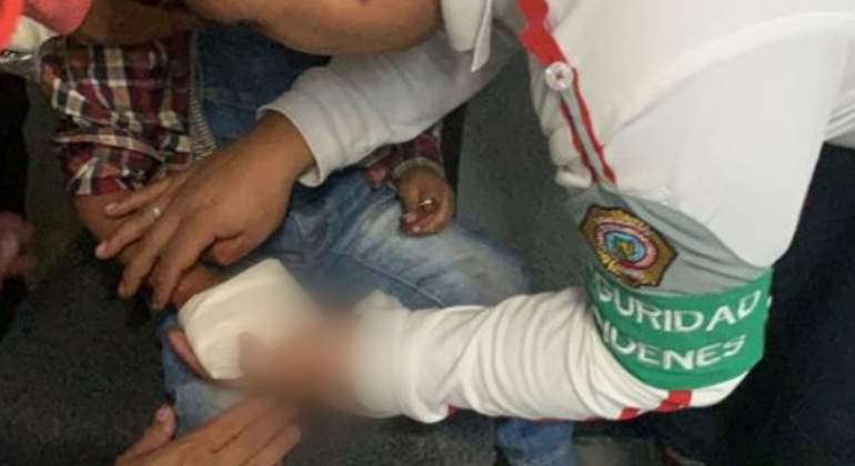 menor-herido-mano-metro-770-420.jpg
