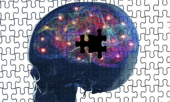 Cerebro-dopamina-dreamstime.jpg