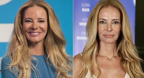 Paula Vázquez reaparece con el rostro hinchado