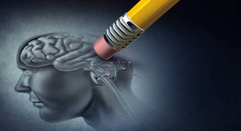 cerebro-demencia-istock-770.jpg