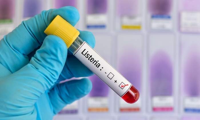 listeria.jpg